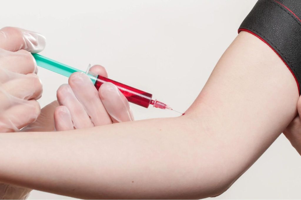 Tired or Lightheaded? What Might Happen After You Get Your Blood Drawn